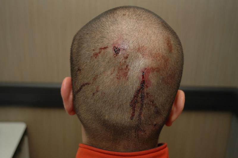 Zimmerman_back_of_head___timenewsfeed_files_wordpress_com.jpg